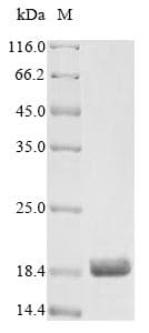 Rat ARTN / Artemin Protein (Recombinant 10His, N-terminus + Myc, C-terminus)