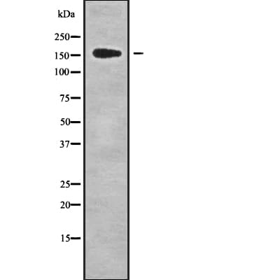 Polyclonal Rabbit anti-Human GPATC8 Antibody (IHC, WB)