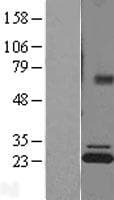 Human ATP5F1 Protein (Over-Expression Lysate Myc-DDK (Flag))