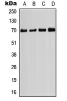 PIF1 Antibody (Internal)