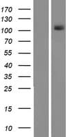 PKN1 Protein (Over-Expression Lysate Myc-DDK (Flag))