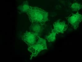 LMCD1 Antibody (clone OTI2G5)