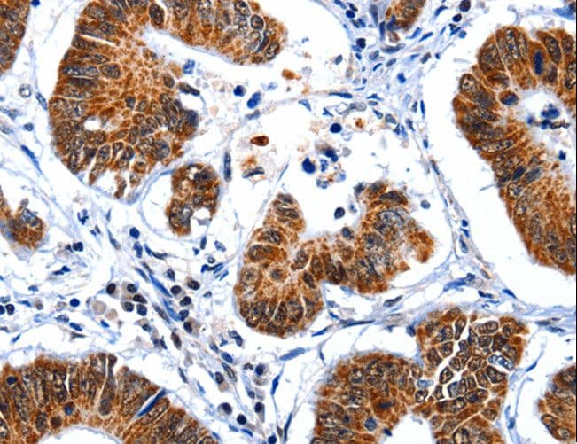 GSK3A / GSK3 Alpha Antibody