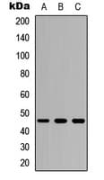 Polyclonal Rabbit anti-Human CSF2RA / CD116 Antibody (Internal, WB)