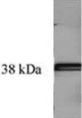 TGM / Transglutaminase Antibody (clone 3C7)