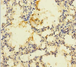 Polyclonal Rabbit anti-Human PRSS23 Antibody (aa20-383)