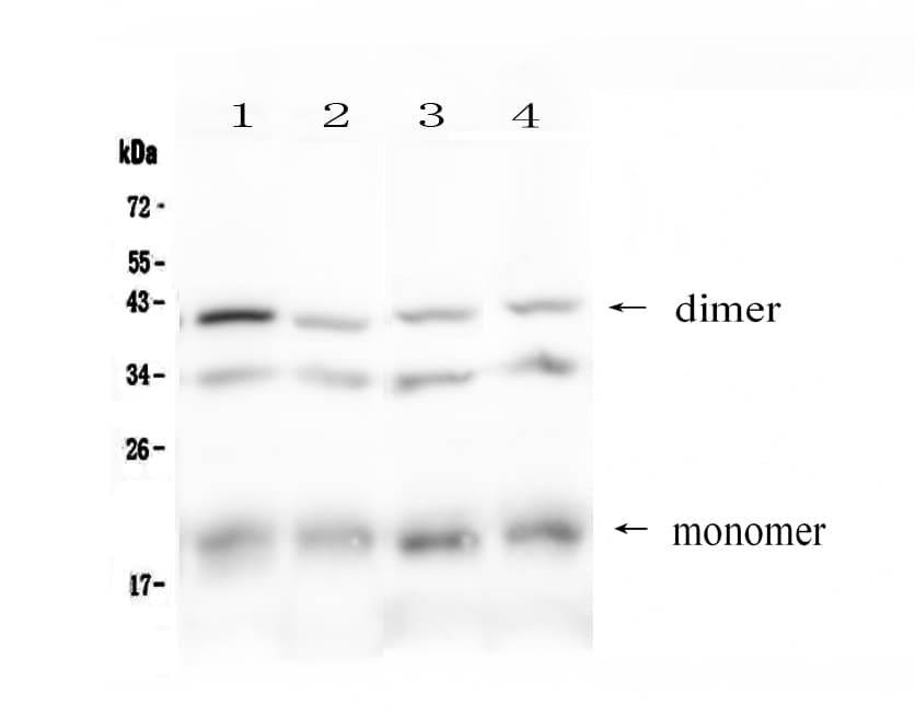 BAFF Receptor / CD268 Antibody
