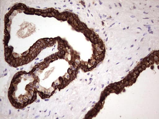 KRT19 / CK19 / Cytokeratin 19 Antibody (aa240-390, clone OTI5B11)