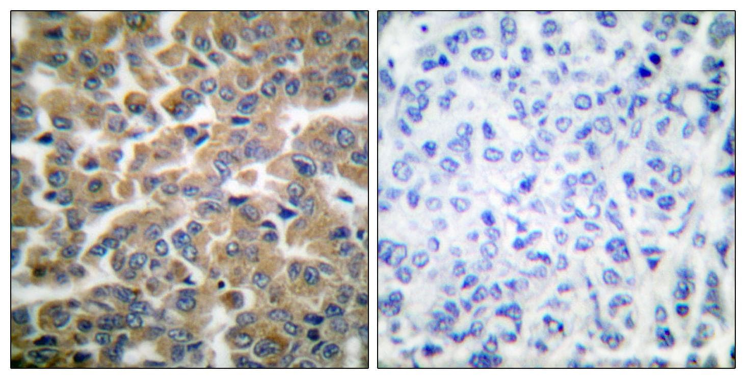 BCL2L11 / BIM Antibody