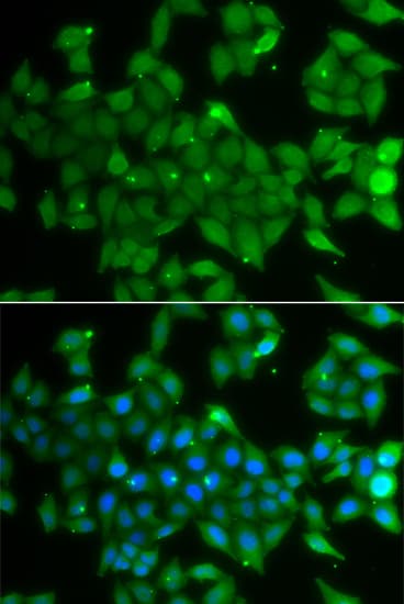 ANXA11 / Annexin XI Antibody