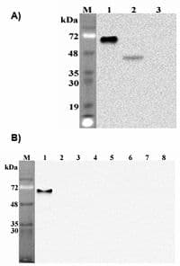 IHC-plus™ Monoclonal Mouse anti-Human DLK1 / Pref-1 Antibody (clone PF299-1, Extracellular Domain, IHC, WB)