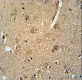 CCZ1 / CGI-43 Antibody (aa239-265)
