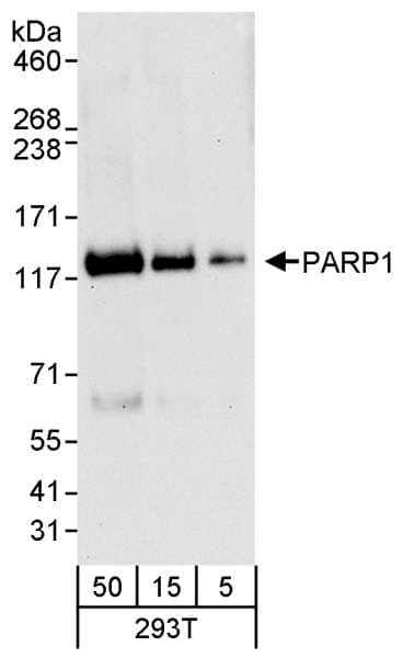 Polyclonal Rabbit anti-Human PARP1 Antibody (aa50-100, IHC, IF, WB)