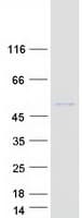 Human POC1A / SOFT Protein (Recombinant Myc-DDK (Flag))