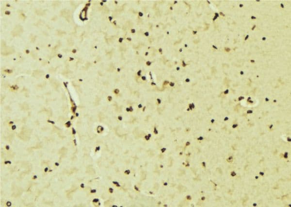 NEUROD1 Antibody