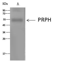 Peripherin Antibody (Preservative Free)