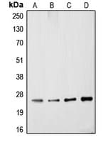 IHC-plus™ UCHL1 / PGP9.5 Antibody (Internal)