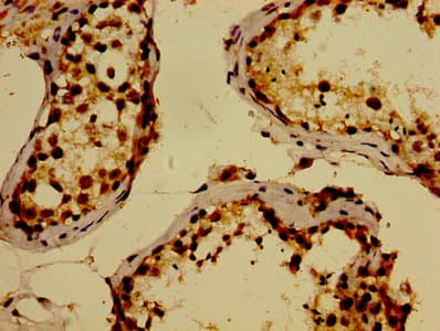 Polyclonal Rabbit anti-Human WWOX Antibody (IHC, WB)