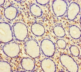 Polyclonal Rabbit anti-Human HUS1 Antibody (WB)