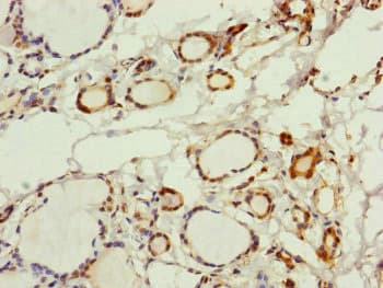 PGLS / 6PGL Antibody