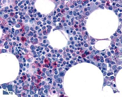 PathPlus™ Polyclonal Rabbit anti-Human FPR2 / FPRL1 Antibody (Extracellular Domain, IHC)