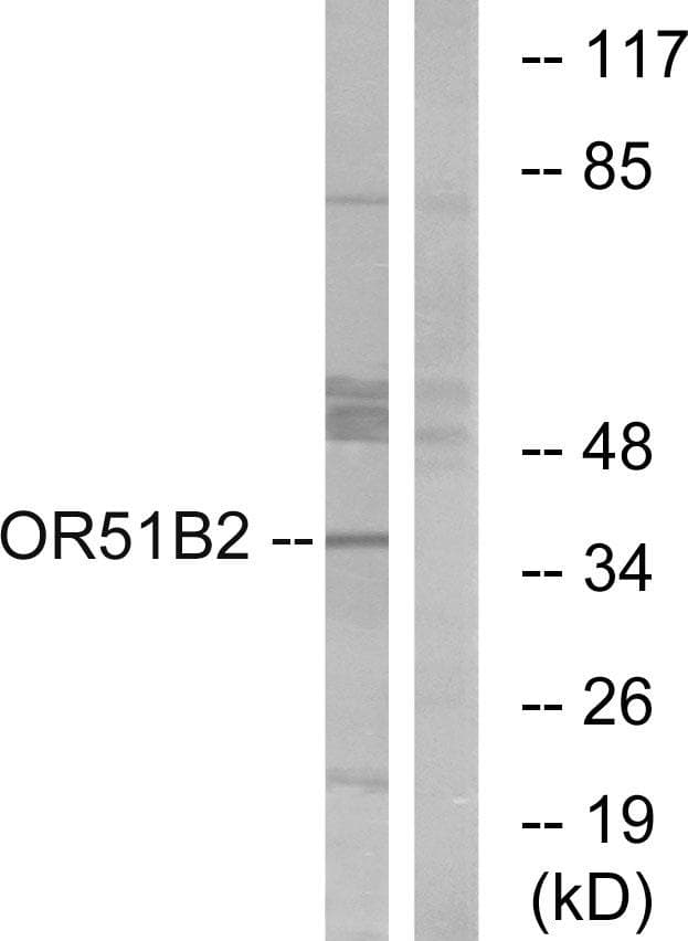 OR51B2 Antibody