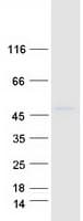Human KIAA1826 Protein (Recombinant Myc-DDK (Flag))