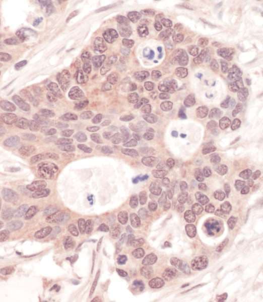 Polyclonal Rabbit anti-Human RNGTT / HCAP Antibody (aa350-400, IHC, WB)