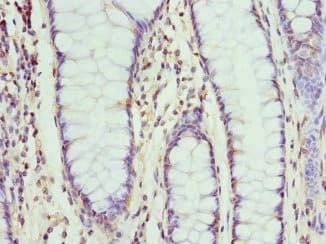 Polyclonal Rabbit anti-Human NMU / Neuromedin U Antibody (IHC, WB)