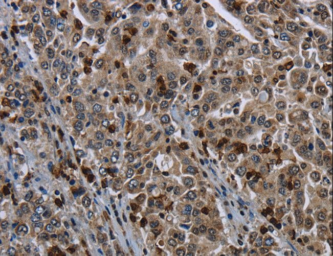 IHC-plus™ GP1BA / CD42b Antibody