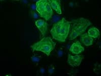 Monoclonal Mouse anti-Human RASSF1 / RASSF1A Antibody (clone OTI3C2, Carrier-free, IF, WB)