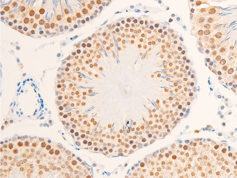 NR3C1/Glucocorticoid Receptor Antibody (phospho-Ser203)