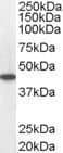 IHC-plus™ MCAD / ACADM Antibody (aa441-454)