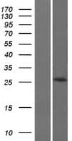 Human HOXB8 Protein (Over-Expression Lysate Myc-DDK (Flag))