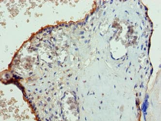 PGS1 Antibody