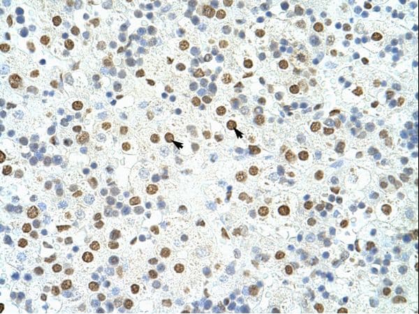 HNRNPA3 / HnRNP A3 Antibody (N-Terminus)