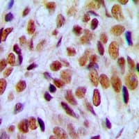 UBTF / UBF Antibody (Internal)