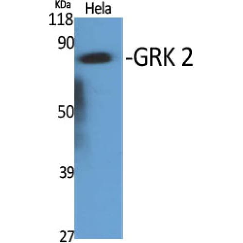 ADRBK1 / GRK2 Antibody (570-650 aa, C-terminal)