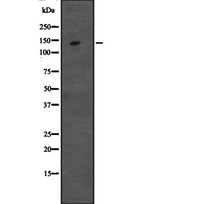 Polyclonal Rabbit anti-Human DIS / CCAR1 Antibody (WB)