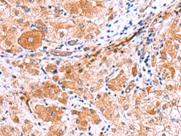 IRGC1 / CINEMA Antibody