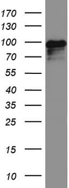 Monoclonal Mouse anti-Human MCAM / CD146 Antibody (clone UMAB155, Carrier-free, IHC, WB)