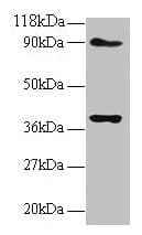 IHC-plus™ NDUFS5 Antibody