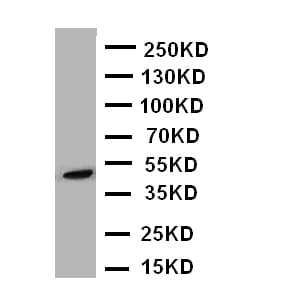 ARRB2 / Beta Arrestin 2 Antibody (aa395-409)