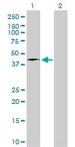 Monoclonal Mouse anti-Human FASN / Fatty Acid Synthase Antibody (clone 3F2-1F3, IF, WB)