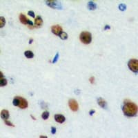 CSTF2T Antibody (Internal)