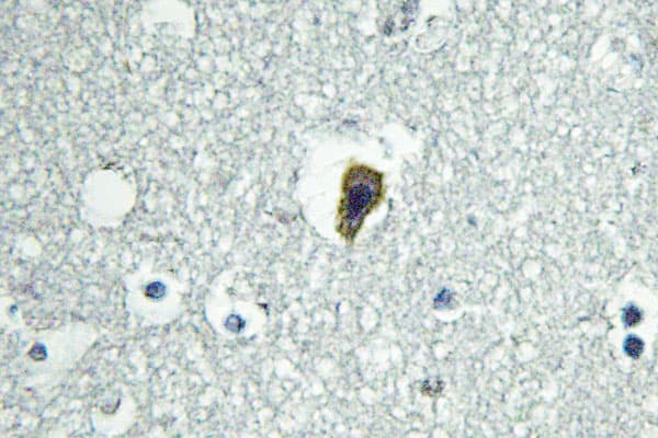 Polyclonal Rabbit anti-Human ADGRB1 / BAI1 Antibody (Gln732, IHC, IF, WB)