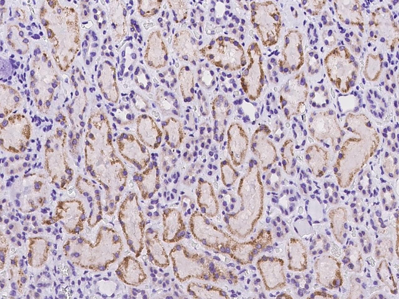 Polyclonal Rabbit anti-Human C18orf32 Antibody (IHC)