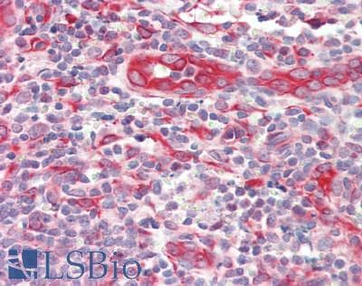 IHC-plus™ IL2RA / CD25 Antibody