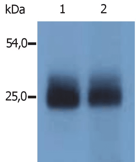 LAT2 / NTAL Antibody (aa124-203, clone Polyclonal)