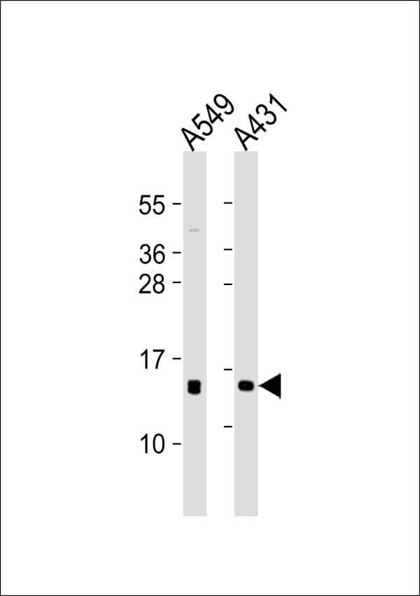 Polyclonal Rabbit anti-Human POLR2I Antibody (WB)